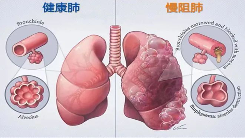 【醫(yī)院動(dòng)態(tài)】了解你的肺功能